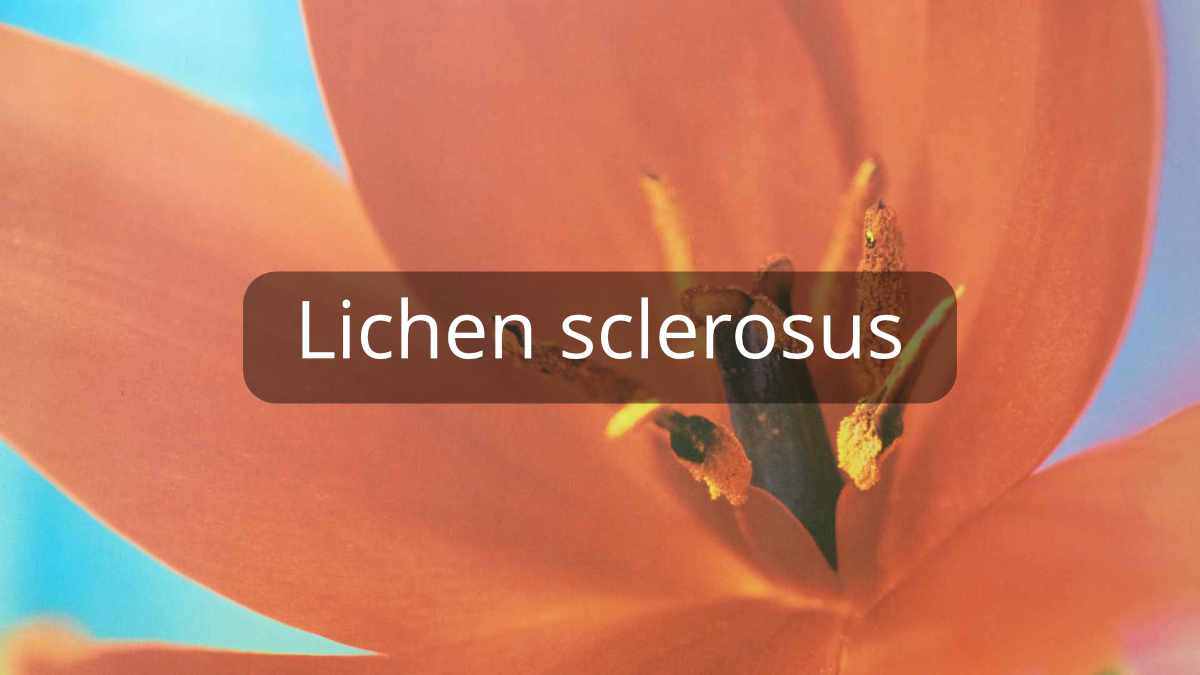 images/leistungen/Dr-Don_Leistungen_Lichen-sclerosus.jpg#joomlaImage://local-images/leistungen/Dr-Don_Leistungen_Lichen-sclerosus.jpg?width=1200&height=675
